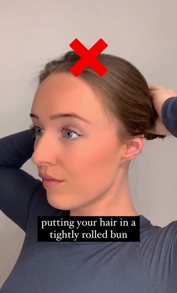 This hairstyle is a big no if you want healthy looking hair