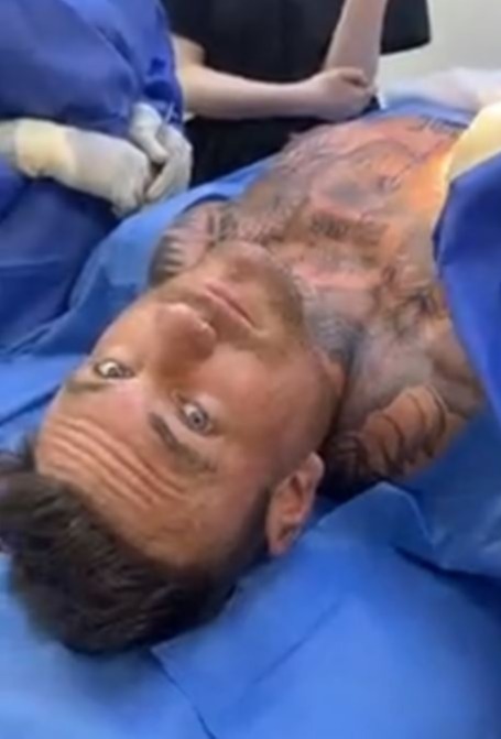 The reality star shared his operation to help break taboos