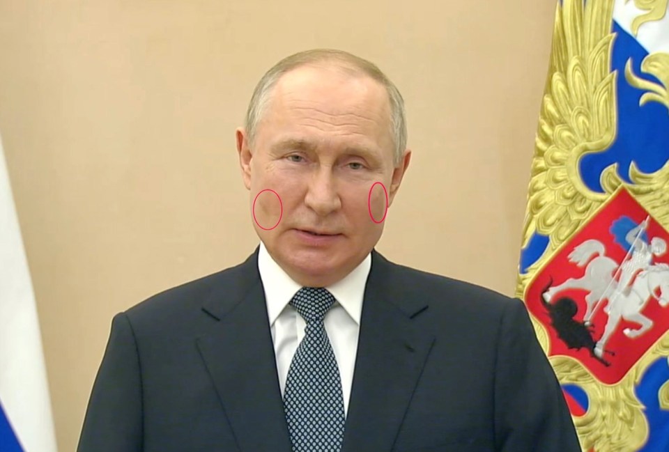 Mysterious blotches appear to be marking Putin's cheeks in a video message