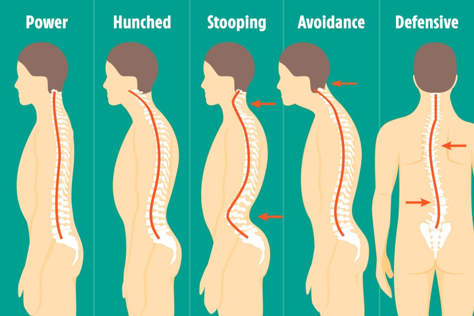 The image above shows the different posture types you might have