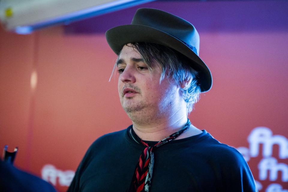 Pete Doherty revealed he had both earlobes bitten off