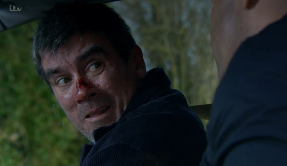 Al Chapman snapped Cain Dingle's leg tonight in horror scenes