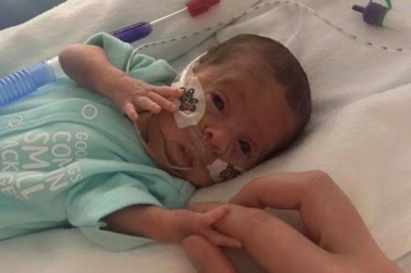 Little Hunter survived despite his premature birth which left him weighing less than a bag of sugar