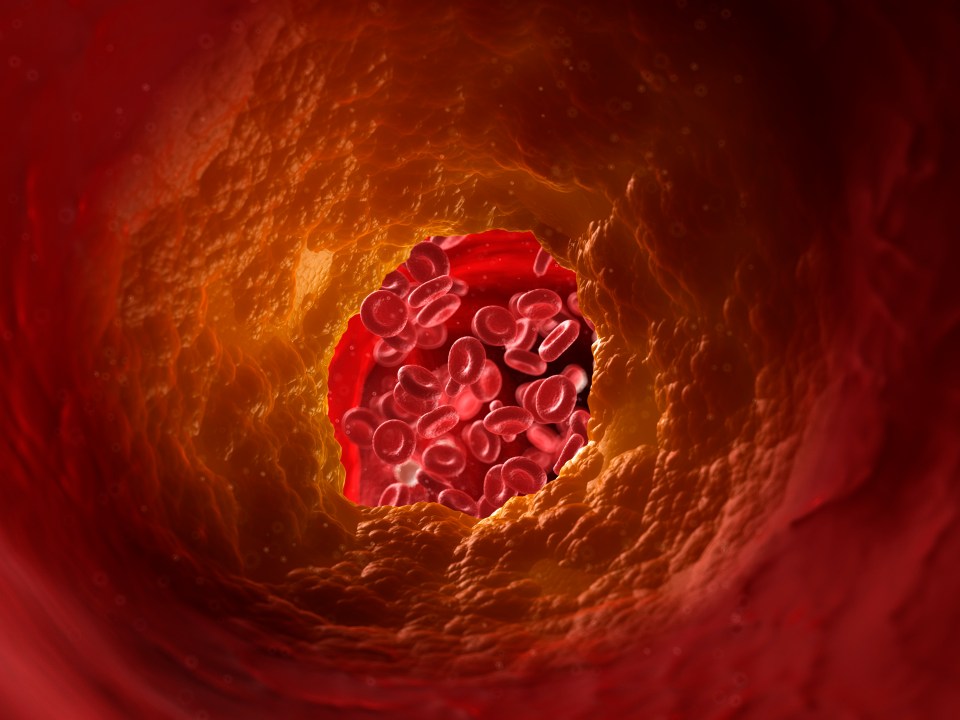 Around 40 per cent of Brits are thought to suffer with high, or borderline high cholesterol levels