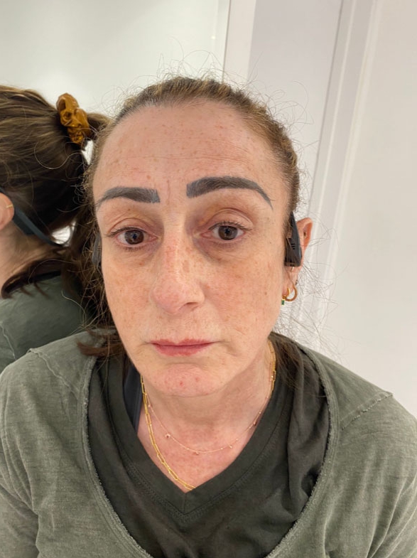 Debbie said she was left speechless when she saw her brows for the first time. Pictured, after the botched procedure