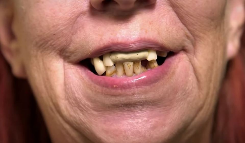 For a more realistic look, Sue would also stain her DIY teeth with some coffee