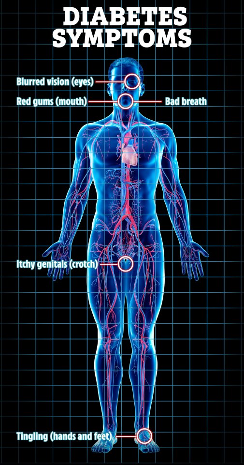 Signs across the body that signal diabetes