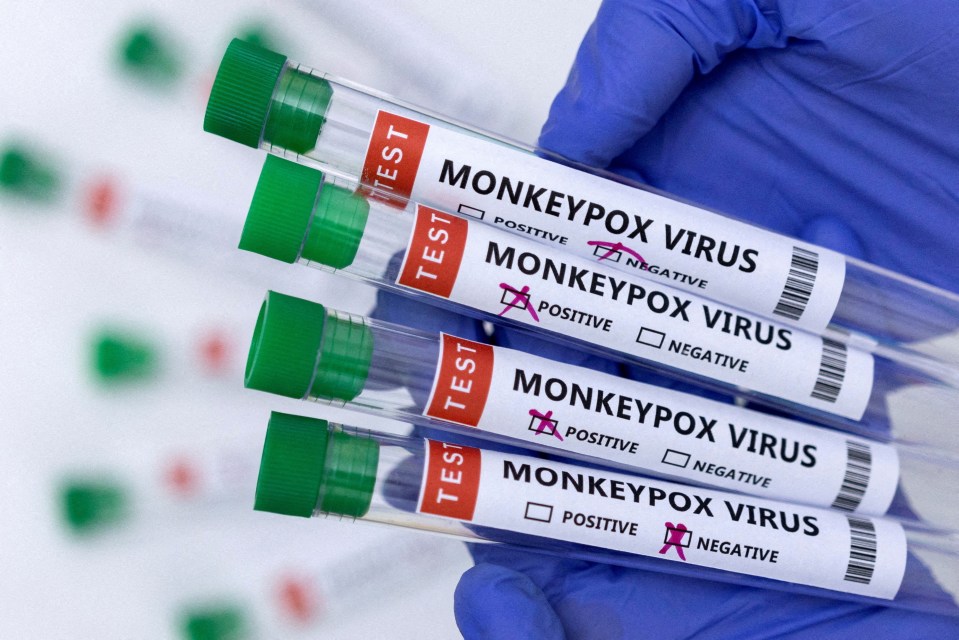 Monkeypox cases have risen dramatically globally