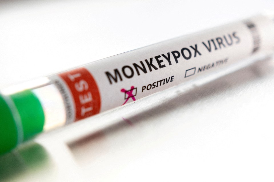 Two children in the US have tested positive for monkeypox