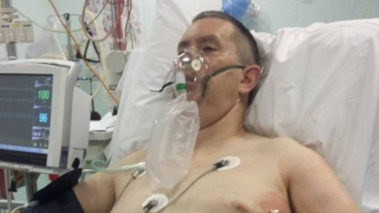 SJamie Cunningham, 48, almost died when he was attacked by a stingray