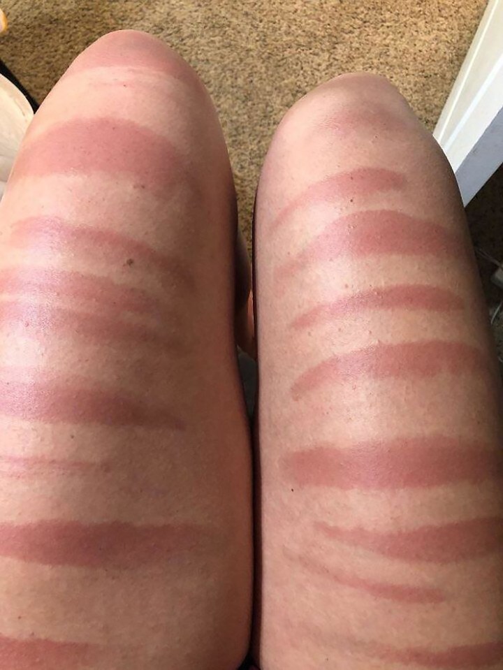 Another person shared the struggles of wearing ripped jeans in the sun