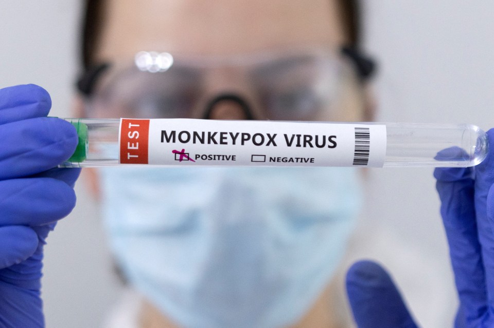 Europe's first monkeypox fatality has been confirmed. The victim died in Spain, which has been particularly badly-hit by the disease