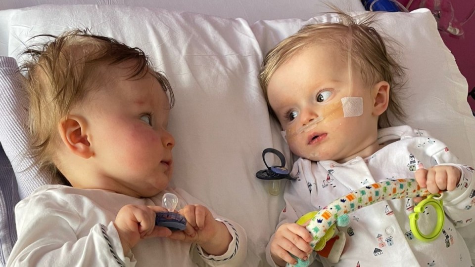 The twins will need expensive treatment, something that just isn't in reach for the Essex family