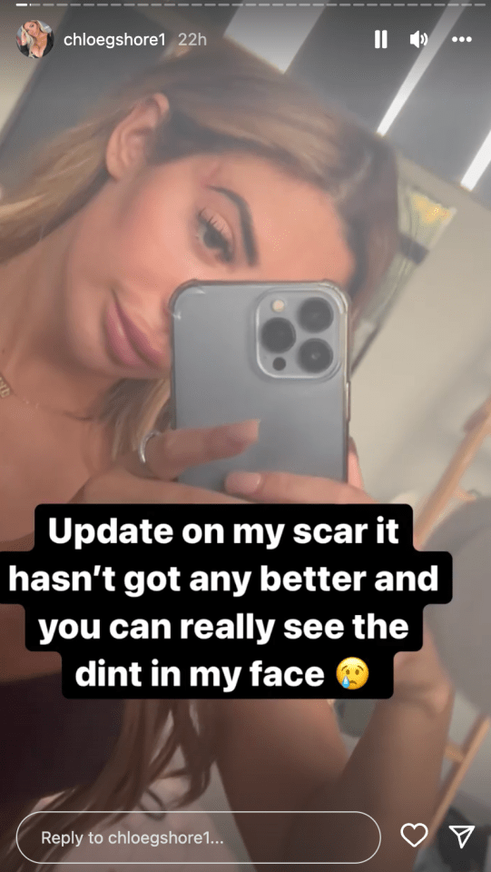 She kept fans updated about her shocking scar