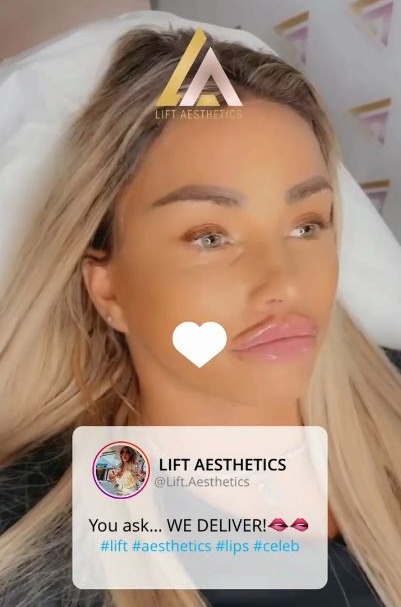 Katie Price showed off her new lips after getting more fillers