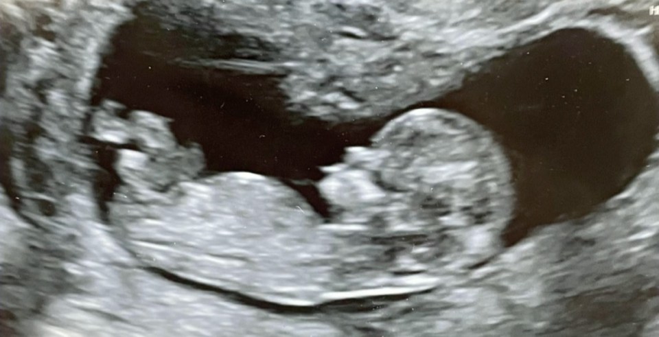 Amy showed off her baby scan on Loose Women