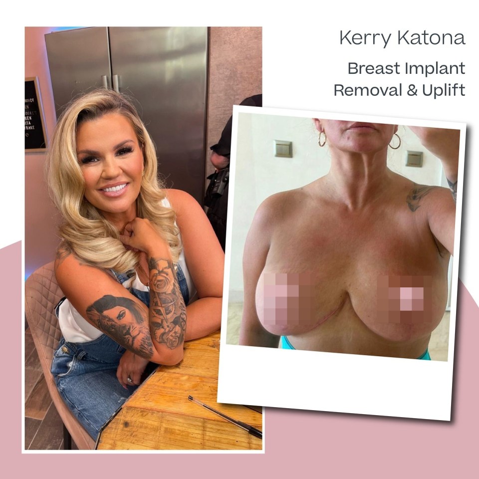 Kerry Katona has revealed her new-look boobs