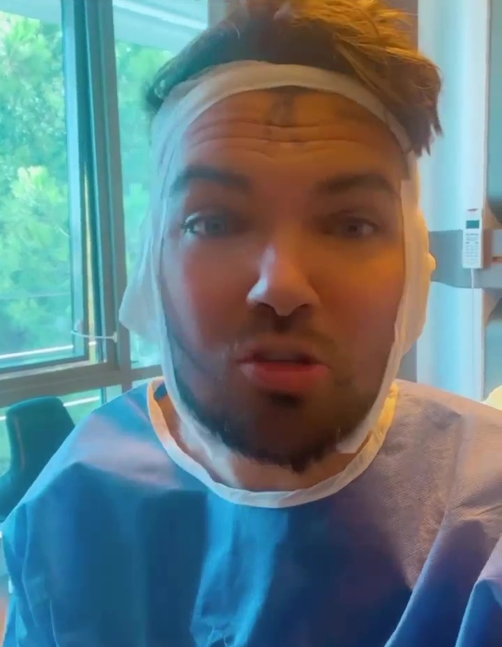 The Love Island star had his face numbed for the procedure