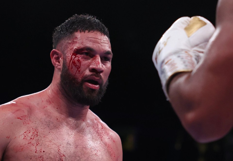 Joseph Parker was left badly cut