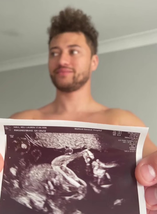 Rak-Su singer Myles shares a photo of their baby scan