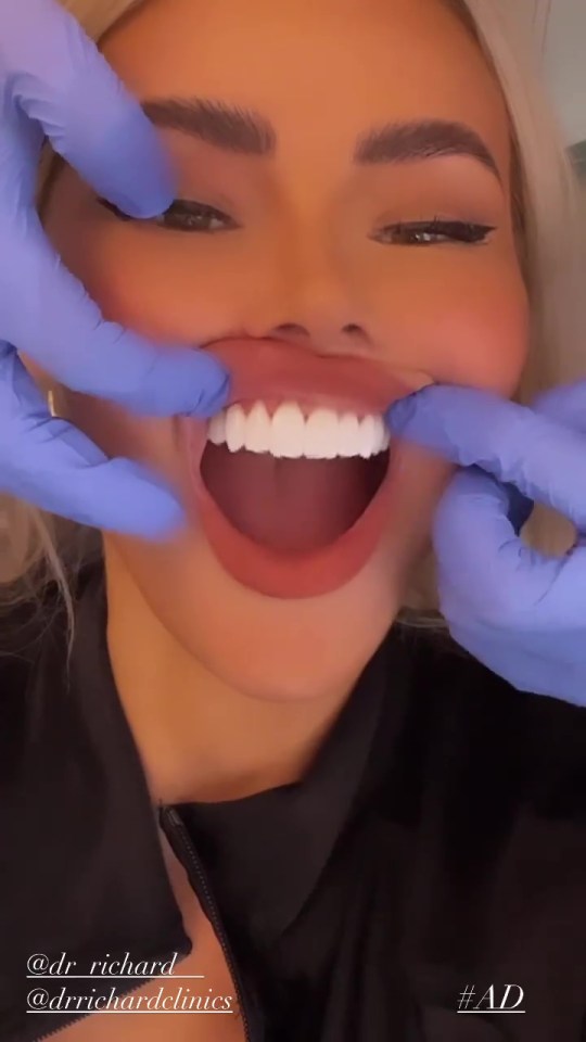 The former TOWIE star, 40, showed off her 'new smile' on her new Instagram page