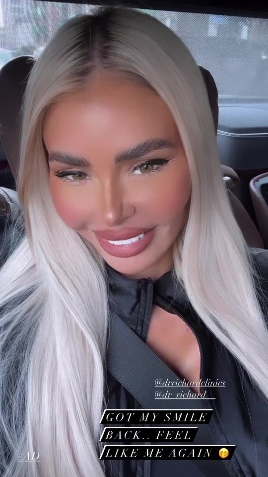 Chloe Sims claimed she feels 'like me again' after a trip to the dentist