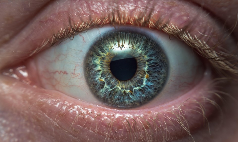 A women’s yellow eye was a rare symptom of stomach cancer