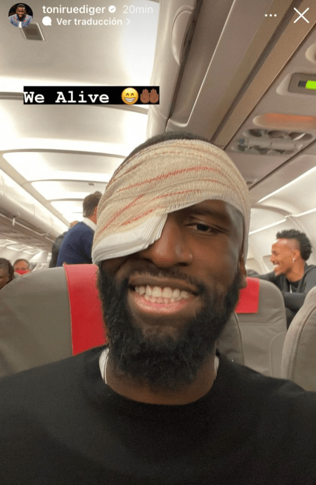 Antonio Rudiger posted from the plane showing a massive eye patch