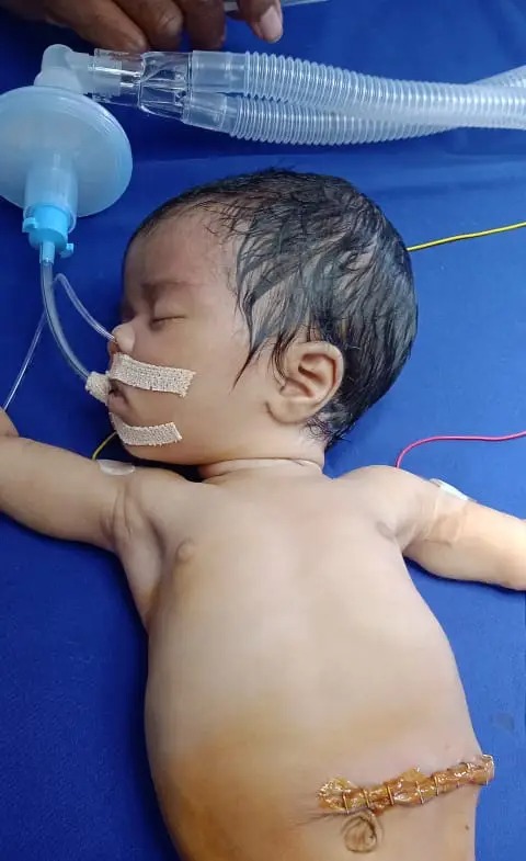 The baby girl was born on October 10 and her parents were concerned about her swollen stomach