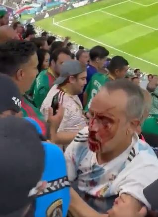 The bloodied and bruised Argentina fan was led away by security