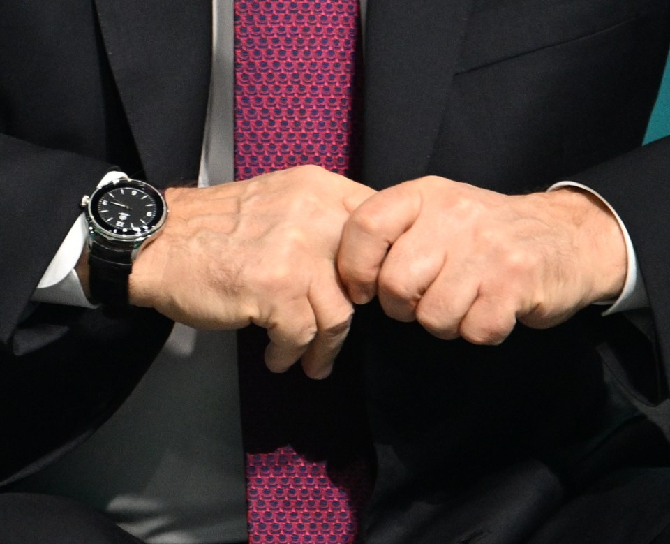 Photos showing a close up of Putin's hands - which appear to be veiny, but not purple