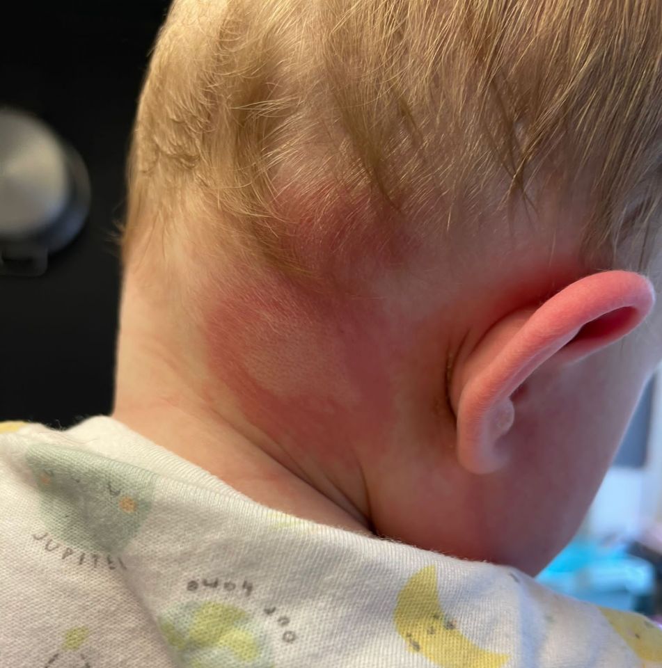 Later, she also noticed he had the marks on his head and on his back