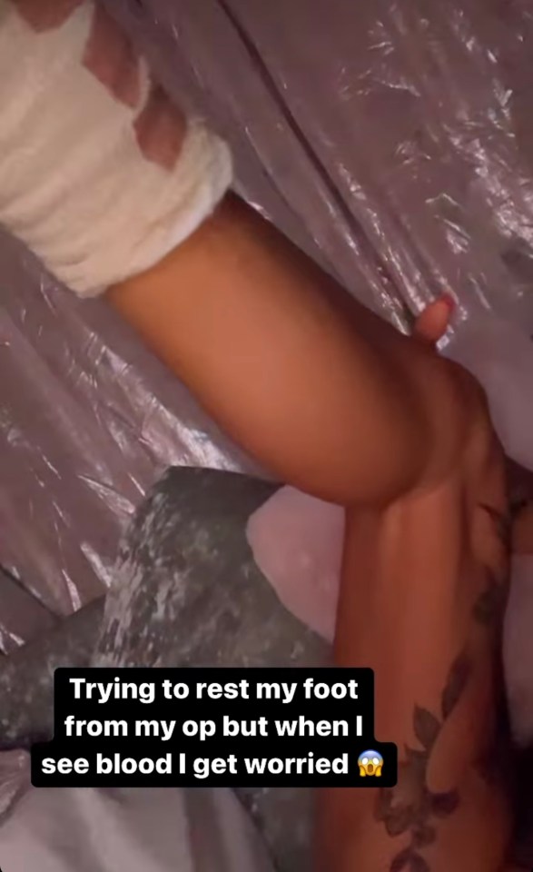 But she has revealed her foot has started to bleed