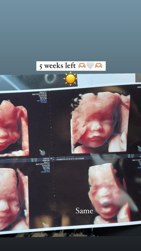 Lucy announced on December 28 the birth was just 5 weeks away