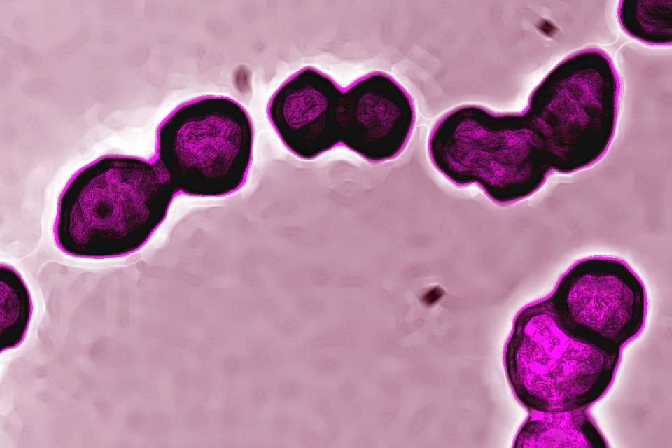 Group A Streptococcus is a common bacteria