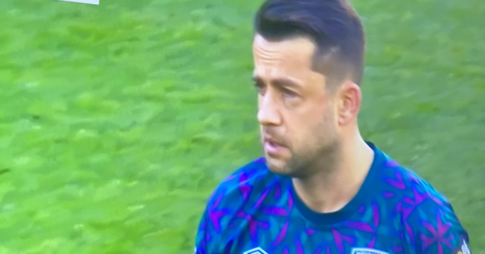 Fabianski was left with a horribly swollen eye