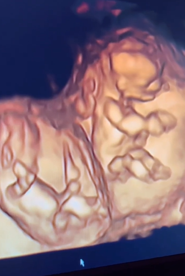 The pair shared a 4D scan video of the twins