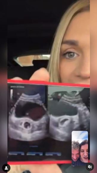 The couple were over the moon to see the scan