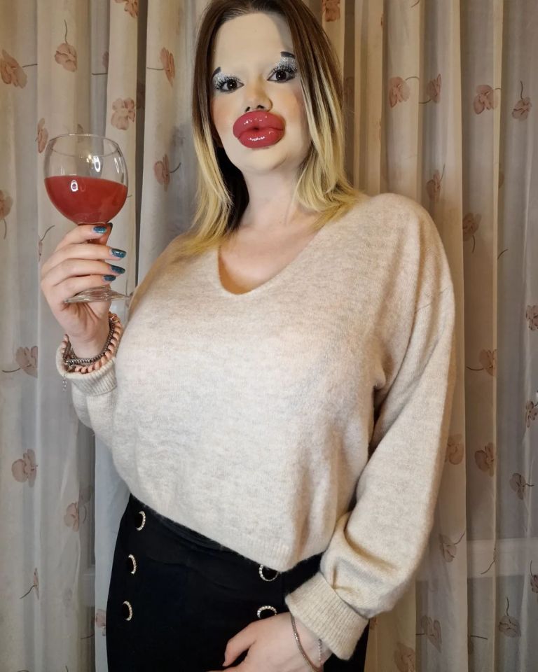 Andrea Ivanova has so far forked out £8,000 on her pout