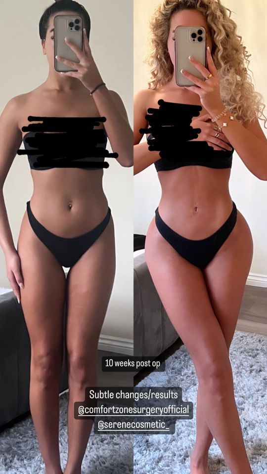 The reality star stripped off to her underwear as she showed off the results of her surgery