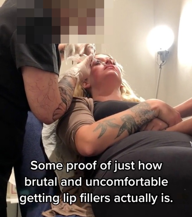 Viewers flocked to the comments of her video with concern about the practitioners injecting technique