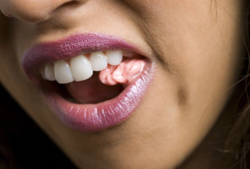 Millions of people suffer extreme emotional reactions to the sound of chewing