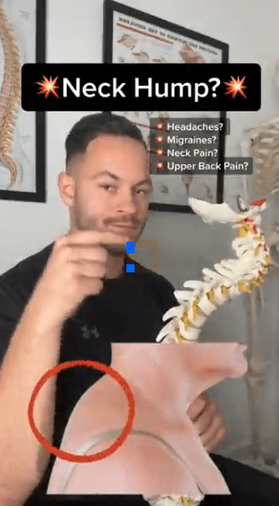 Osteopath Brendon Talbot (pictured) shows how to get rid of a neck hump Credit: btosteopathy