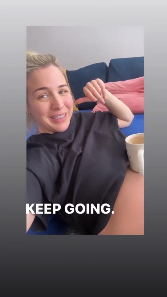 Gemma Atkinson showed off her baby bump and revealed it's hairy