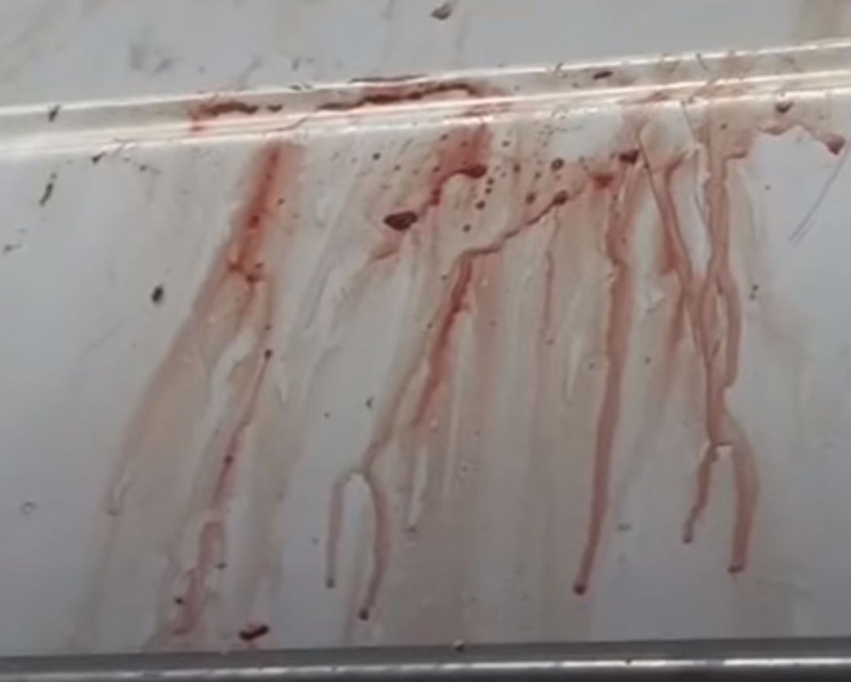 The bloodstained rail from Eric’s boat after his son pulled him to safety