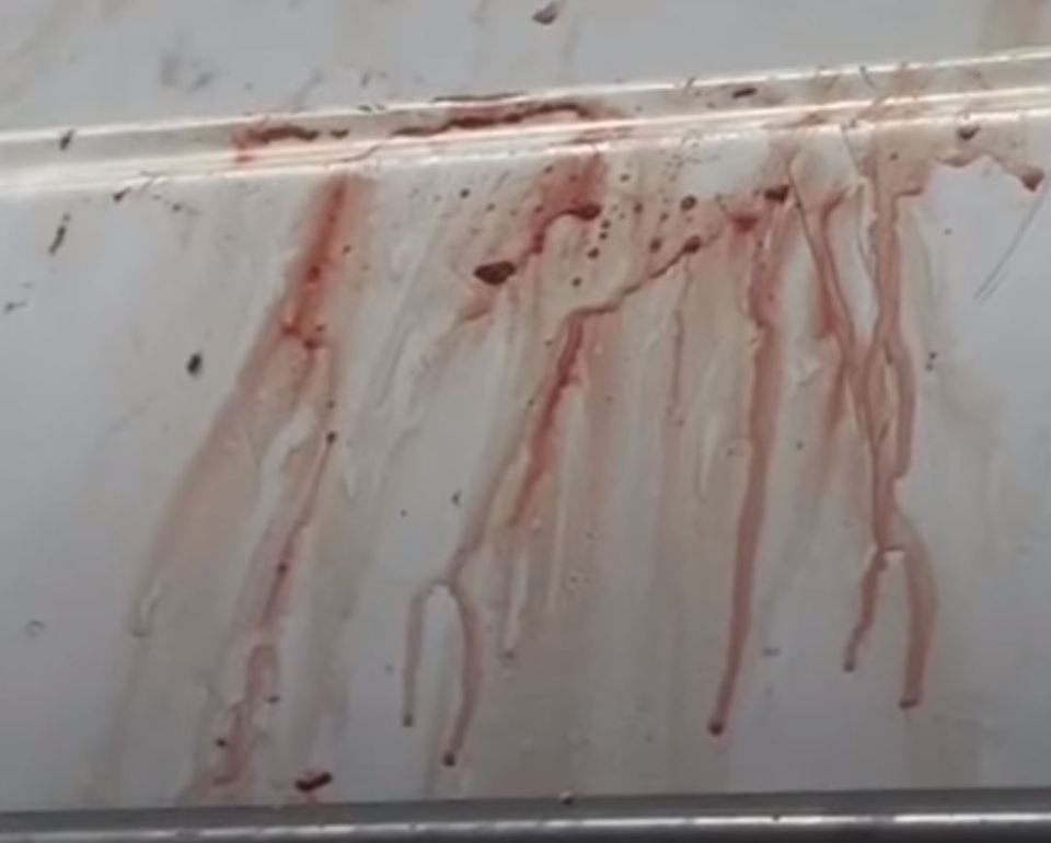 The bloodstained rail from Eric's boat after his son pulled him to safety