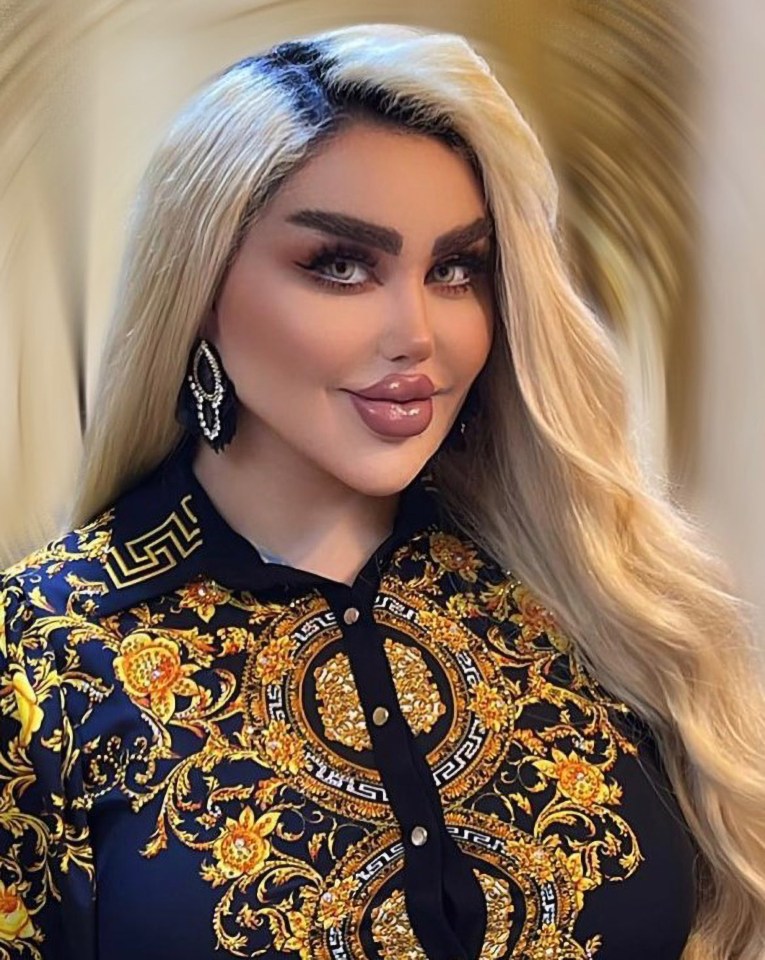 Dalia Naeem went on a plastic surgery spree to turn herself into a real-life Barbie