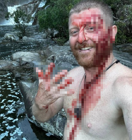 Joey Zayne was left covered in blood after being bitten by a python