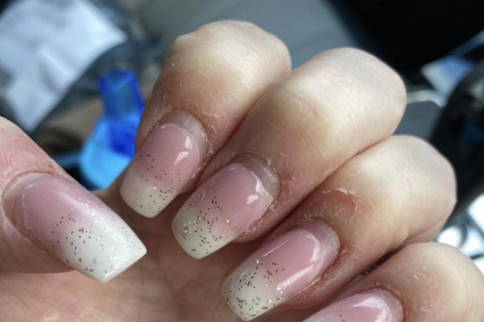 The nail technician from London first noticed that her nails were itchy and starting to lift