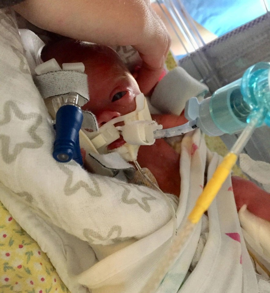 The tiny tot weighed just 493g and doctors gave her a 10 per cent chance of survival